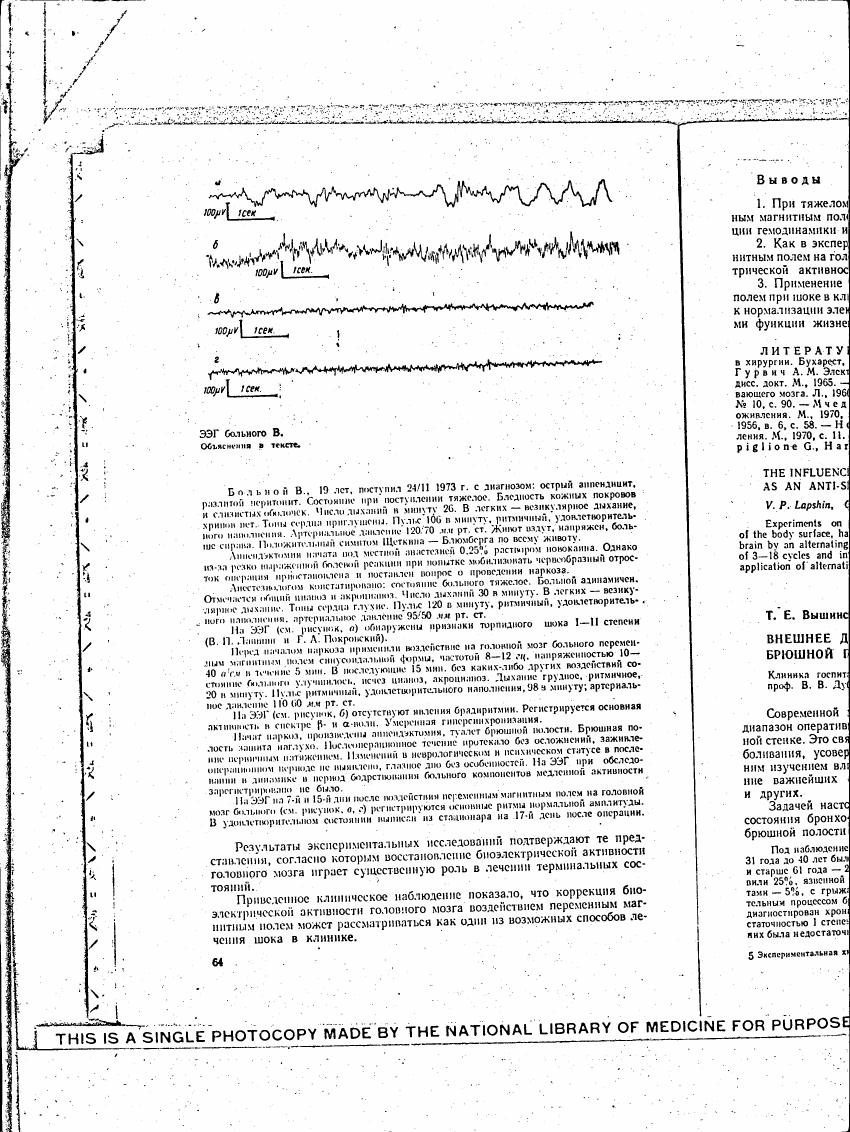 AI-described figure: EEG recording from patient B showing brain electrical activity over time.
