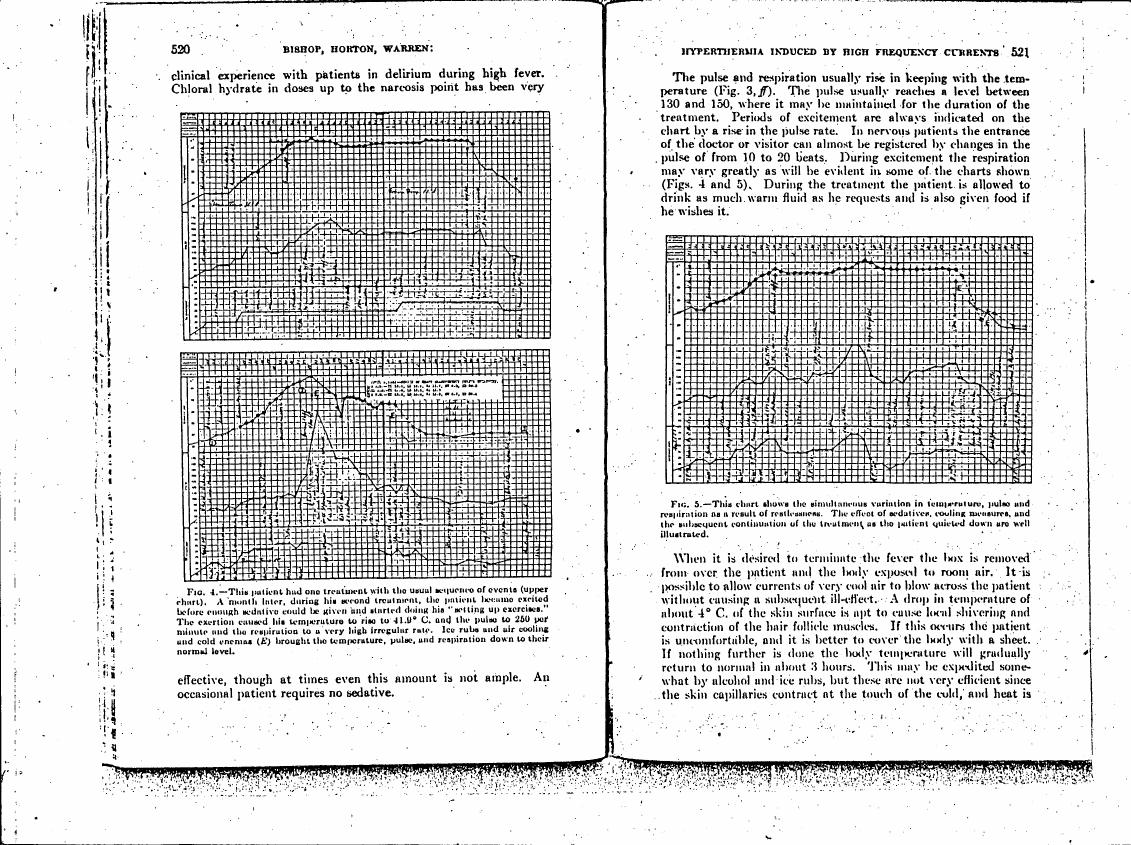 AI-described figure: Fig. 4 illustrates a patient's temperature, pulse, and respiration changes during treatment with high frequency currents.