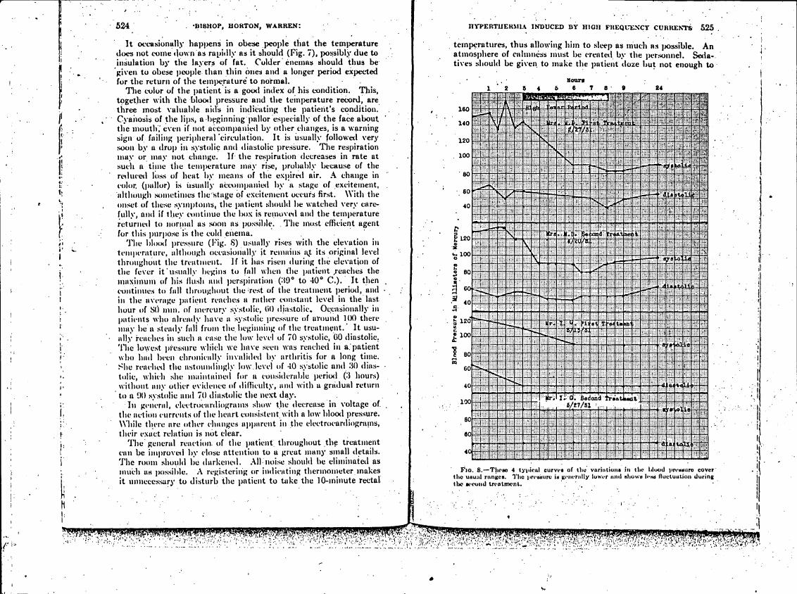 AI-described figure: Four typical curves showing variations in blood pressure during a treatment session.