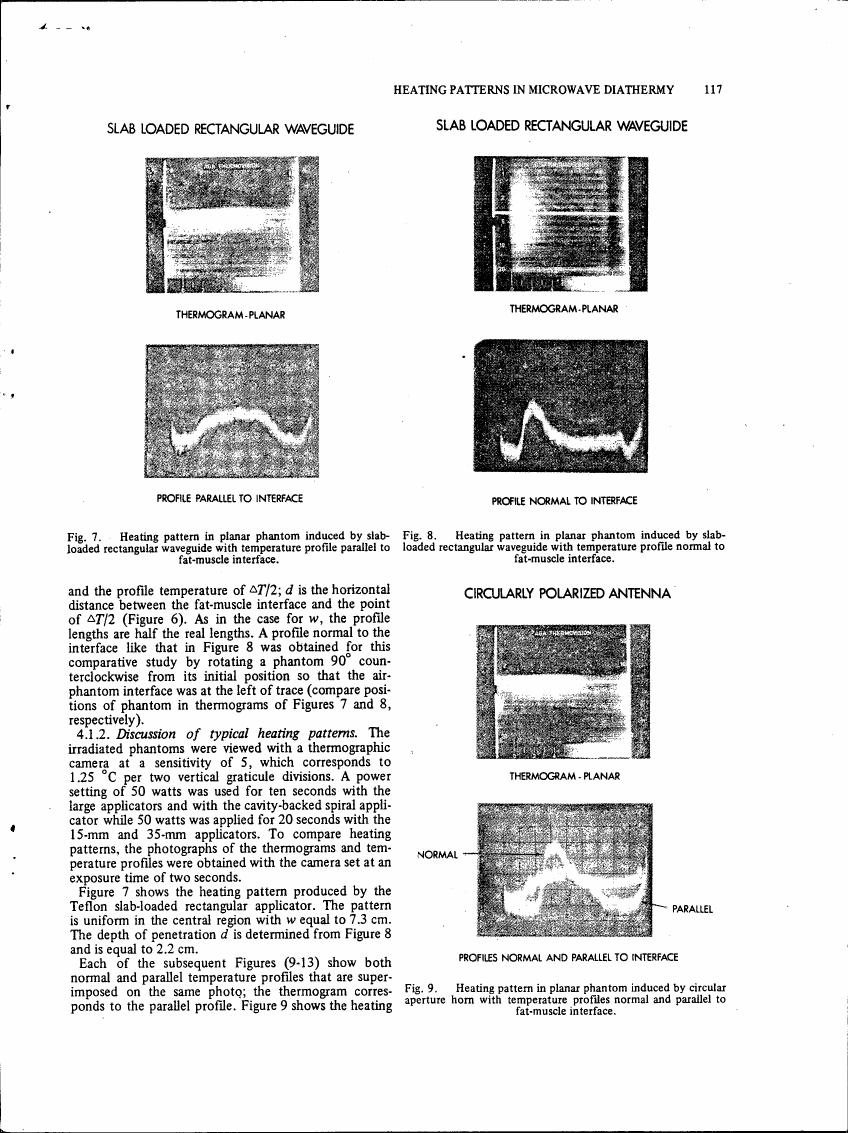 Figure 7 and Figure 8 show heating patterns in planar phantoms induced by slab-loaded rectangular waveguide with temperature profiles parallel to fat-muscle interface.