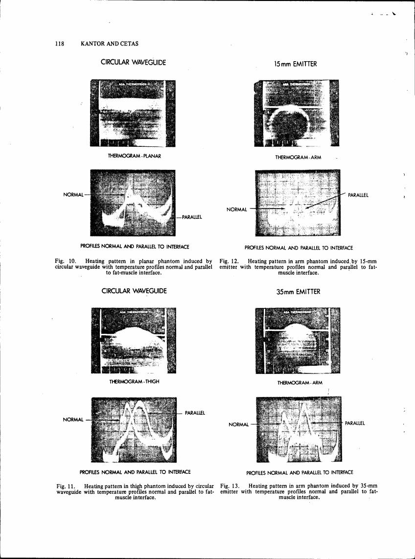AI-described figure: Figures showing heating patterns in phantoms induced by different emitters and waveguides with temperature profiles normal and parallel to fat-muscle interface.