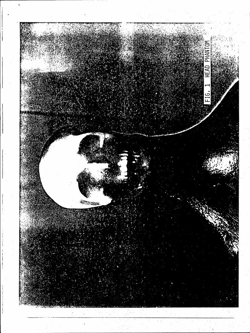 AI-described figure: Figure 1: A head phantom used in a scientific study.