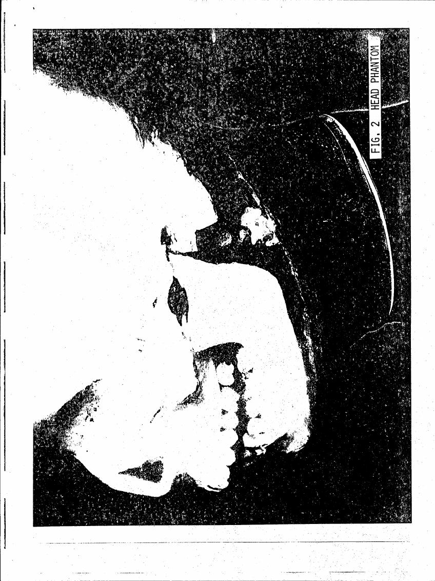 AI-described figure: Figure 2: A head phantom used in a scientific study.
