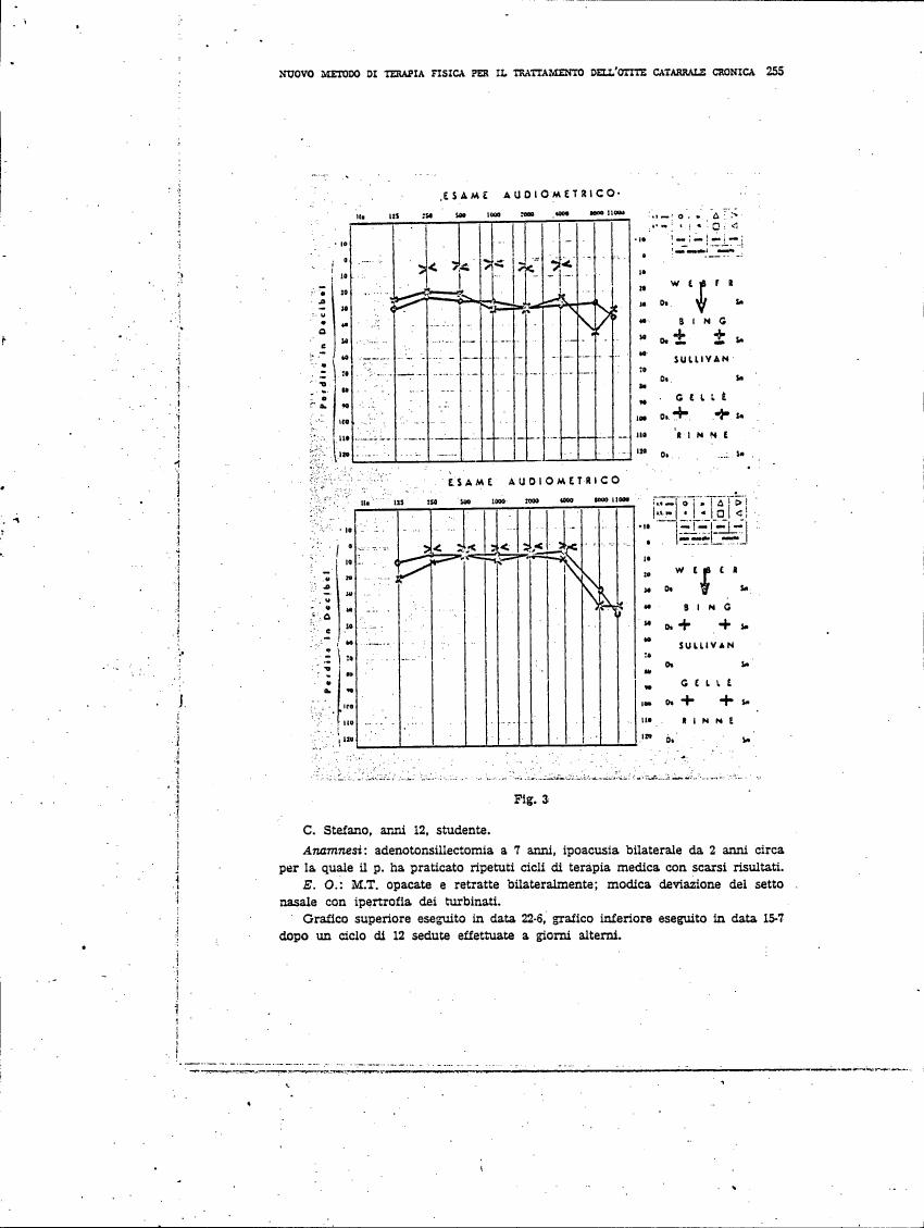 AI-described figure: Audiometric test results for a student with chronic otitis media, comparing hearing loss before and after treatment.
