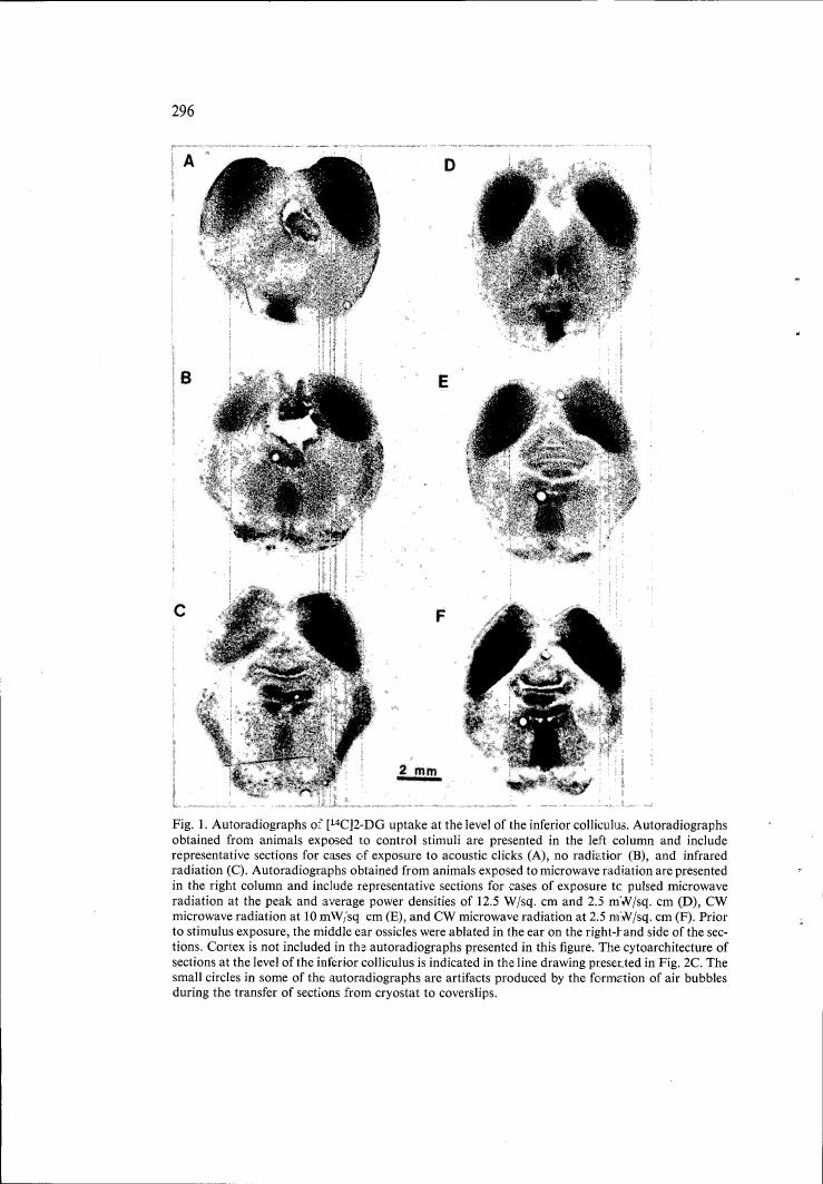 AI-described figure: Autoradiographs showing [14C]J2-DG uptake at the level of the inferior colliculus in response to different stimuli, including acoustic clicks and microwave radiation.