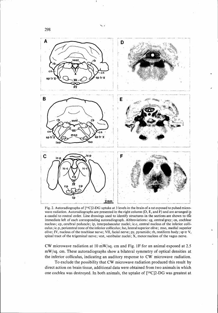 AI-described figure: Fig. 2: Autoradiographs showing [14C]2-DG uptake at three levels in a rat brain exposed to pulsed microwave radiation, arranged from caudal to rostral.