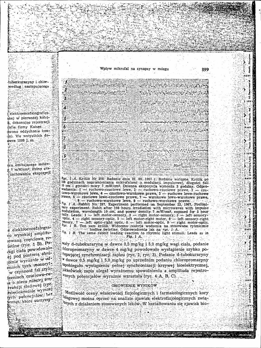 AI-described figure: Figure 1A and Figure 1B show electroencephalographic recordings from a rabbit after microwave exposure with impulse modulation, wavelength 10 cm, and power density 7 mW/cm².