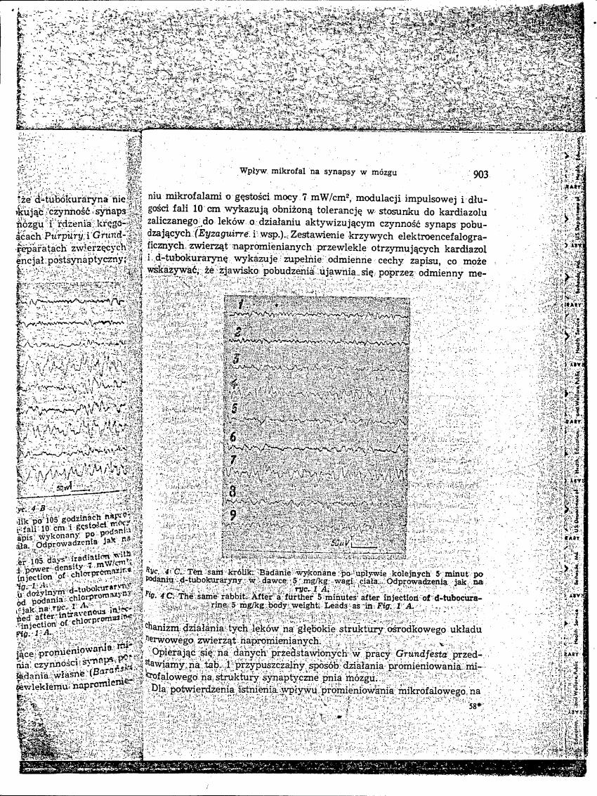 AI-described figure: Electroencephalogram (EEG) recordings from a rabbit after injection of d-tubocurarine and chlorpromazine, showing changes in brain activity over time.