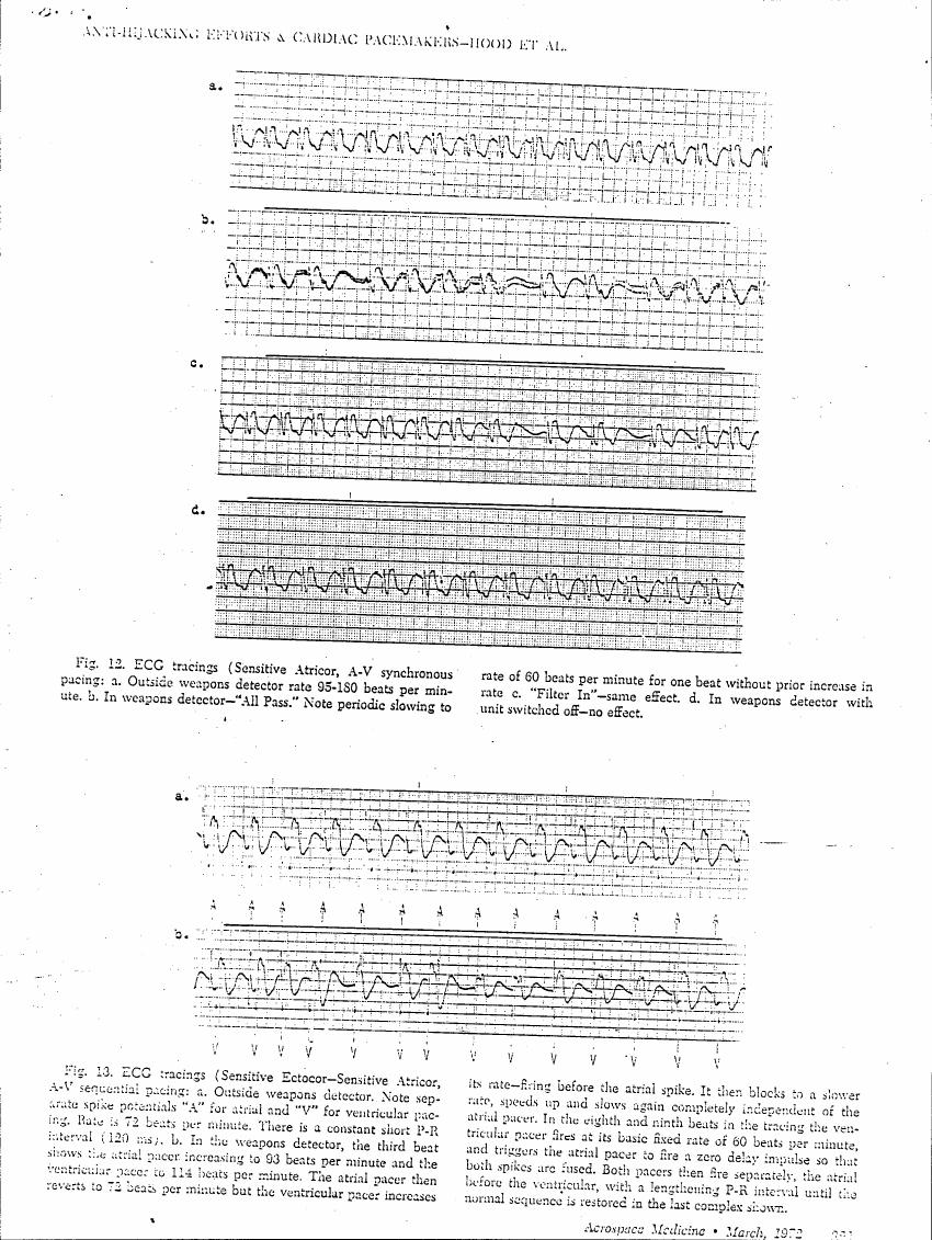 AI-described figure: ECG tracings showing effects of a weapons detector on cardiac pacing rates.