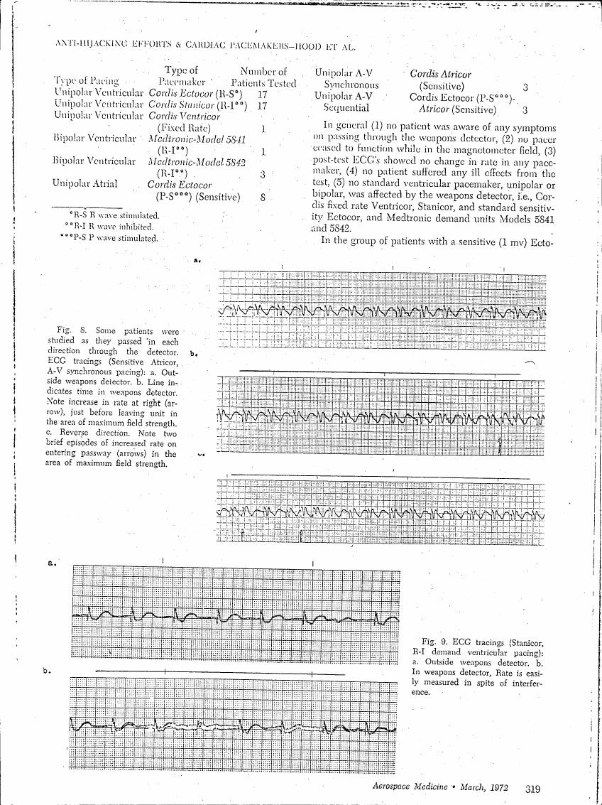 AI-described figure: Figure 8: ECG tracings showing changes in heart rate as patients pass through a weapons detector.