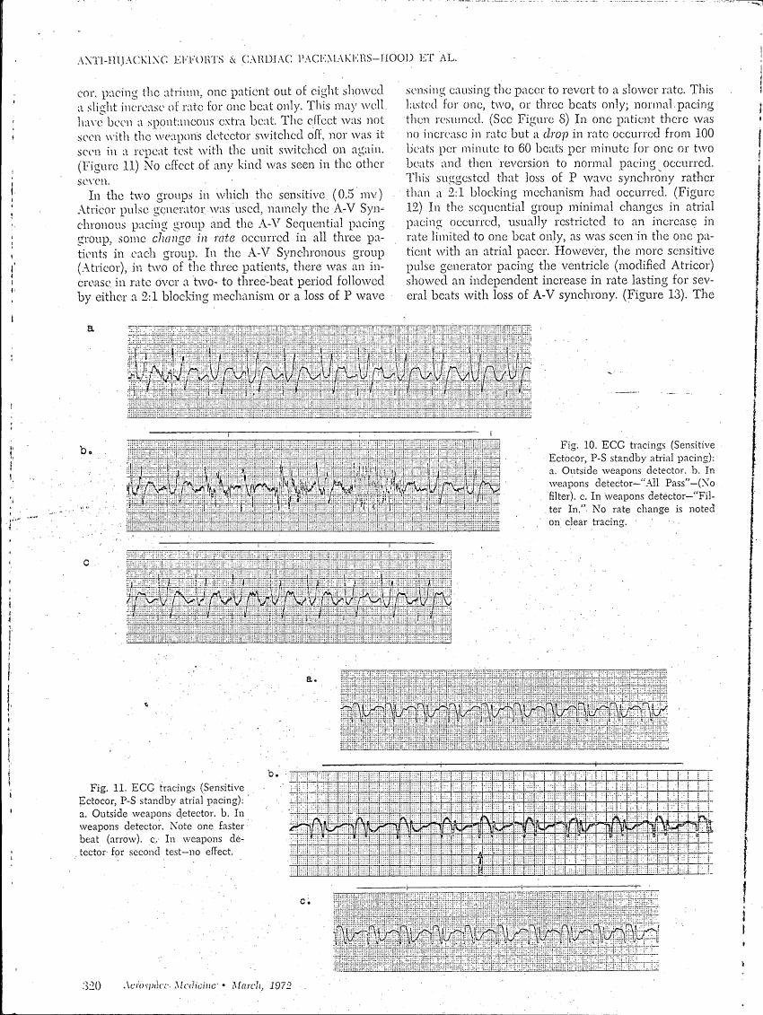 AI-described figure: Figure 10: ECC tracings (Sensitive Ectocor, P-S standby atrial pacing) showing different states of pacing in the presence and absence of a weapons detector.