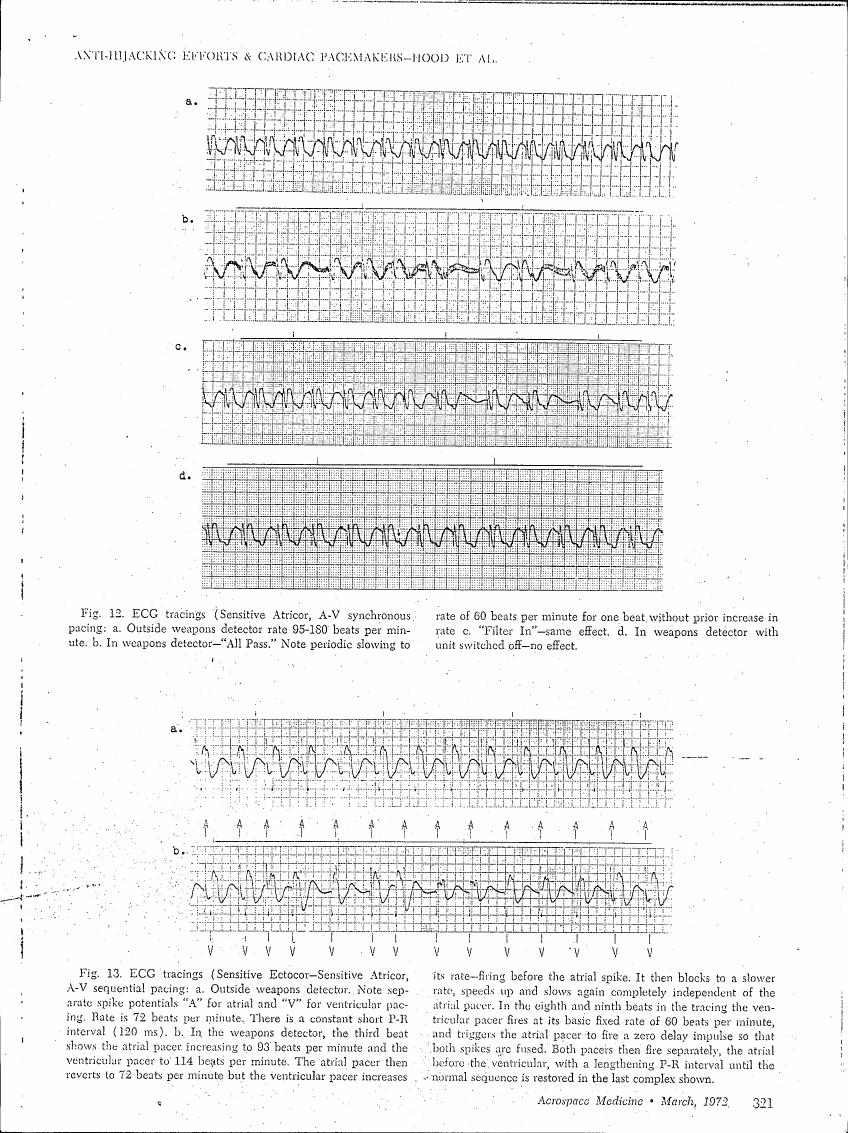 AI-described figure: Figure 12 and Figure 13 display ECG tracings illustrating different pacing modes in cardiac pacemakers under various conditions, including outside weapons detector settings.