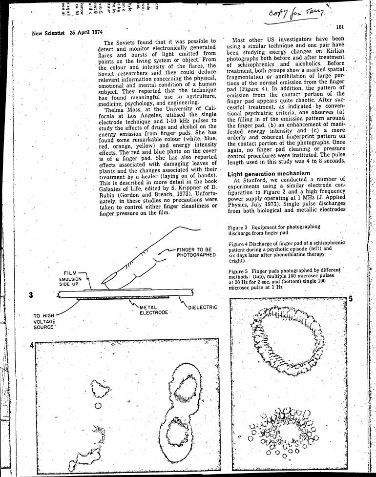 AI-described figure: Figure 3 illustrates equipment for photographing discharge from a finger pad.