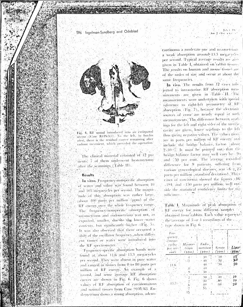 Figure 4 illustrates RF sound introduced into an excised uterus (Case R118/63), showing residual cancer and radiation treatment effects.