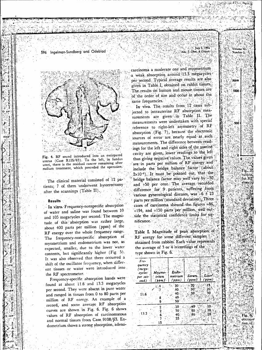 Figure 4 illustrates RF sound introduced into an excised uterus (Case R1S/63), highlighting residual cancer remaining after radiation treatment.