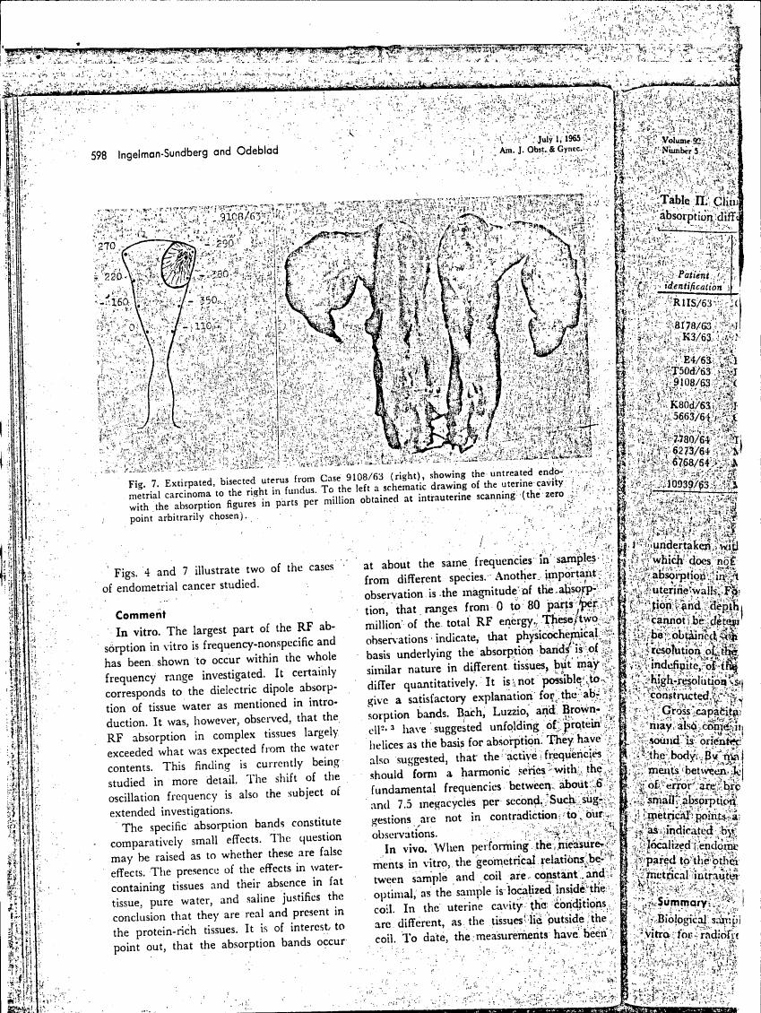 Fig. 7 illustrates an exirpated and bisected uterus from Case 9108/63, showing untreated endometrial carcinoma in the fundus.