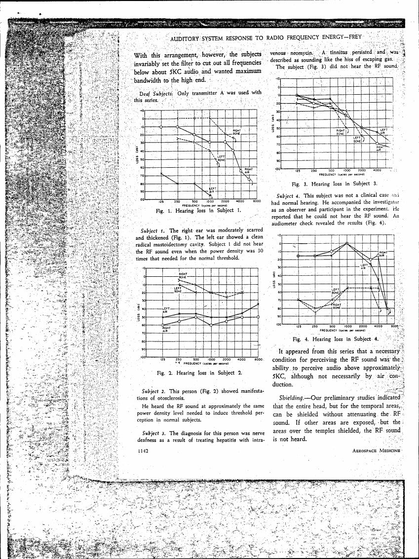 Hearing loss in Subject 1 as shown in Fig. 1.