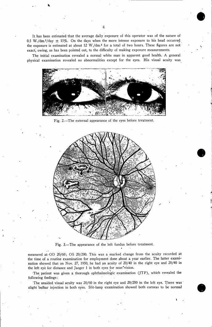 Fig. 2: The external appearance of the eyes before treatment.