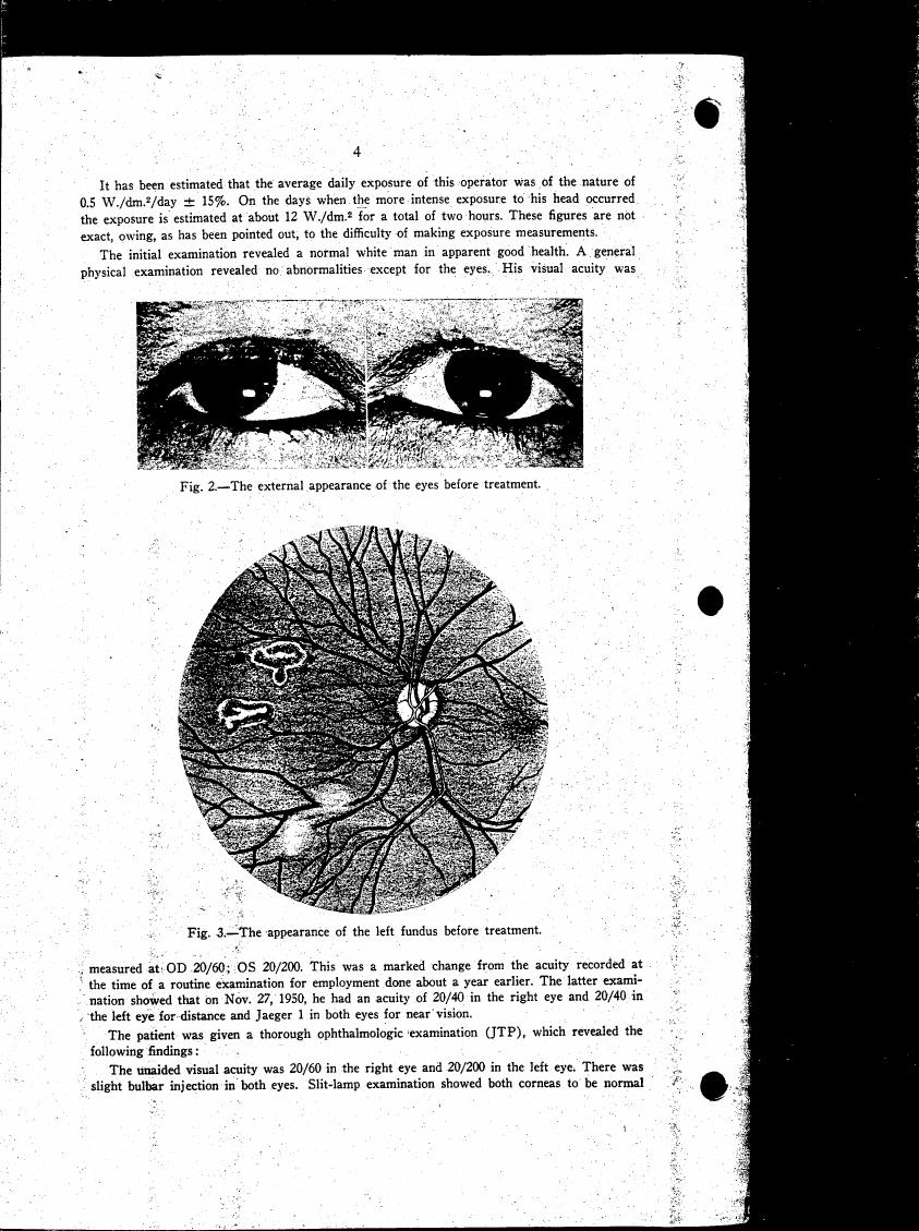 Fig. 2 - The external appearance of the eyes before treatment.
