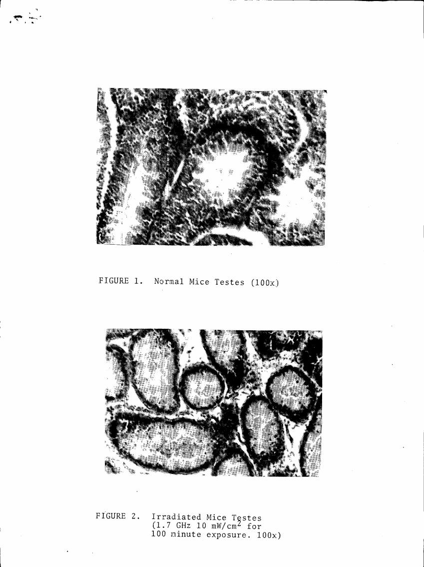 AI-described figure: Figure 1 and Figure 2 show microscopic images of normal and irradiated mouse testes at a magnification of 100x.