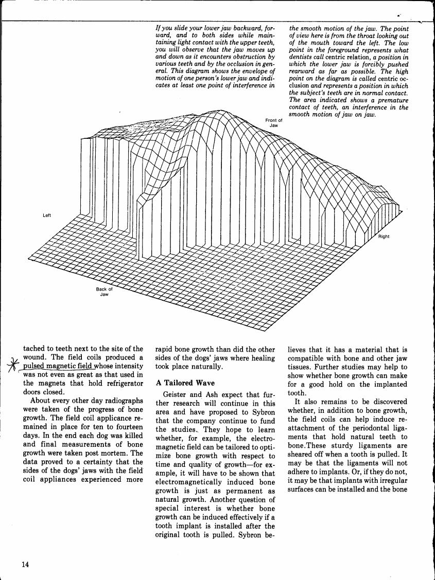 AI-described figure: A three-dimensional diagram illustrating the motion and contact points of a person's lower jaw during various movements.