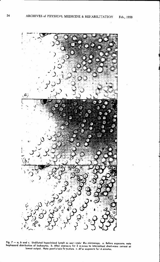 AI-described figure: Fig. 7 - a, b and c: Undiluted heparinized lymph at seen under the microscope showing the distribution of leukocytes before and after exposure to short-wave current.