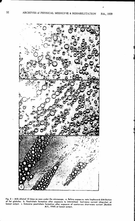 AI-described figure: Figure 5 from Archives of Physical Medicine & Rehabilitation showing milk diluted 15 times under a microscope before and after exposure to different types of electromagnetic fields.