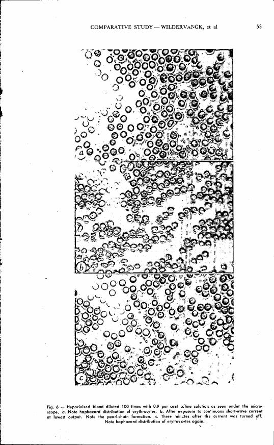 Fig. 6 - Heparinized blood diluted 100 times with 0.9 per cent saline solution as seen under the microscope, showing the distribution of erythrocytes before and after exposure to a continuous short-wave current.