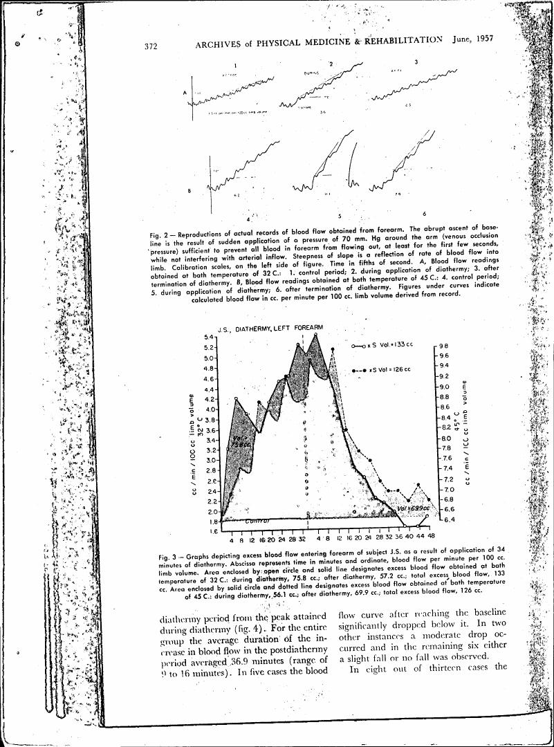 AI-described figure: Fig. 3: Graphs depicting excess blood flow entering forearm as a result of diathermy application.