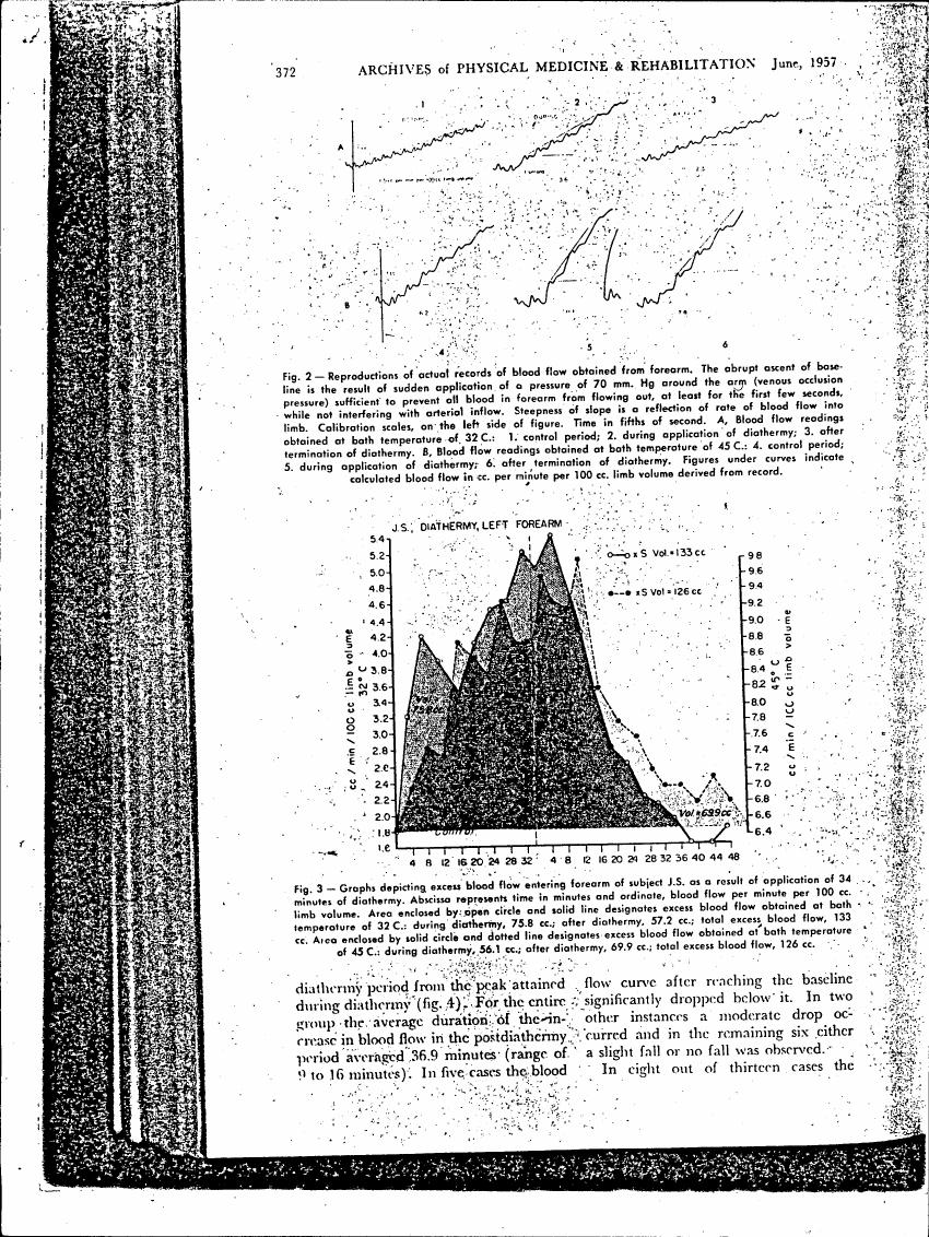 Fig. 3 - Graphs depicting excess blood flow entering forearm of subject J.S. as a result of application of diathermy.