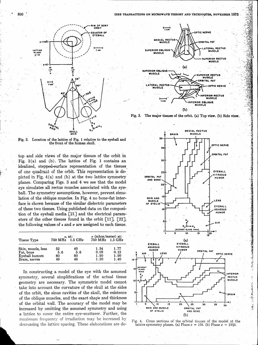 AI-described figure: Fig. 3 displays top and side views of major tissues in the orbit.