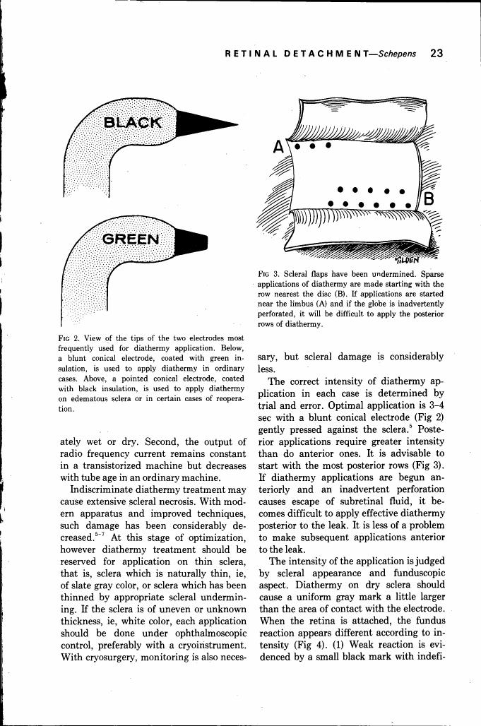AI-described figure: Figures showing different types of electrodes used for diathermy application and a diagram illustrating scleral flaps in retinal detachment surgery.