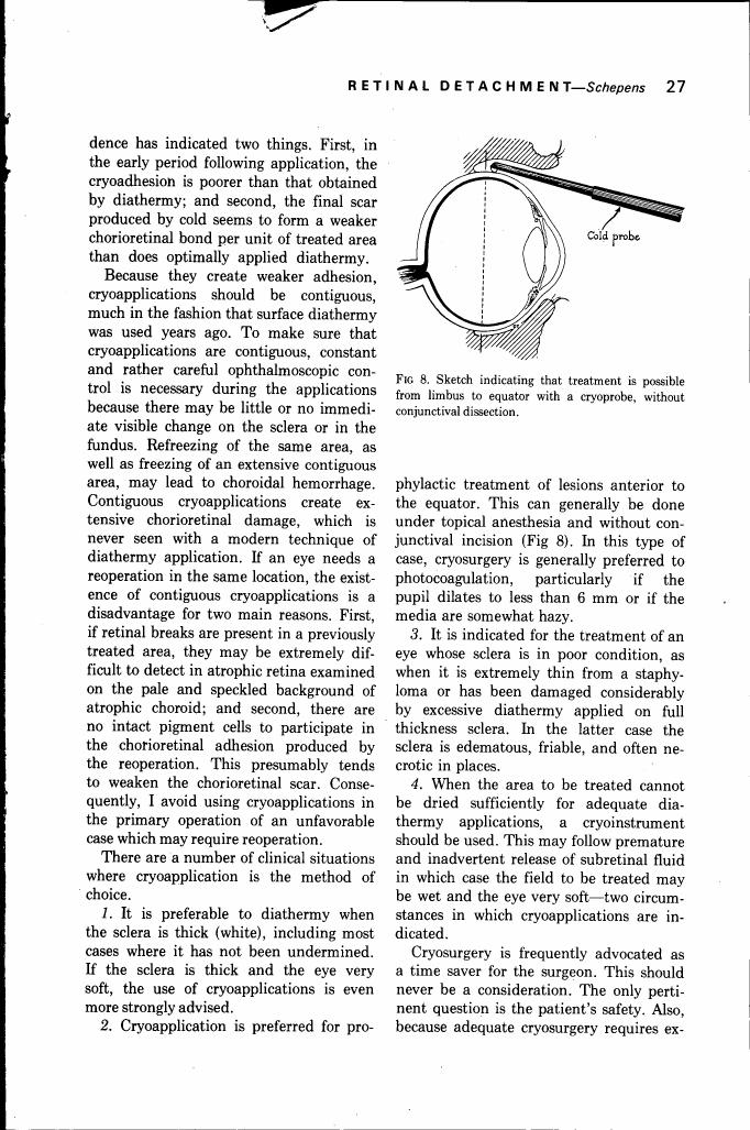 AI-described figure: Figure 8. Sketch indicating that treatment is possible from limbus to equator with a cryoprobe, without conjunctival dissection.