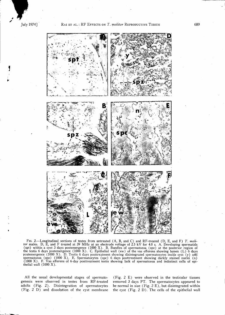 AI-described figure: Fig. 2 - Longitudinal sections of testes from untreated and RF-treated T. molitor males showing various stages of spermatogenesis, including developing spermatozoa within a cyst and disintegration of spermatoocytes.