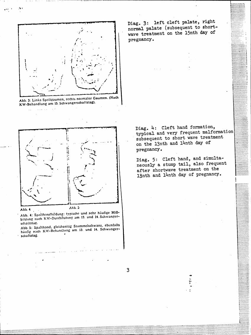 AI-described figure: Diagrams illustrating congenital malformations following shortwave treatment during pregnancy