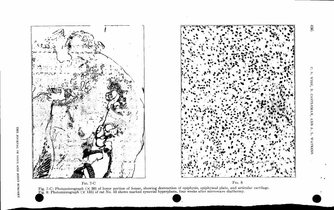 Fig. 7-C: Photomicrograph (×30) of lower portion of femur showing destruction of epiphysis, epiphyseal plate, and articular cartilage.