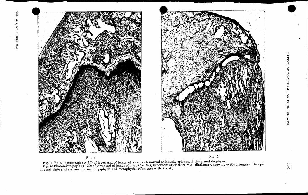 AI-described figure: Photomicrographs showing the lower end of a rat's femur with normal epiphysis and diaphysis in Fig. 4, and two weeks after short-wave diathermy in Fig. 5.