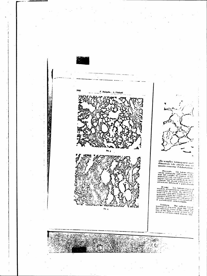AI-described figure: Histological diagram illustrating lung tissue with various cellular and vascular structures.