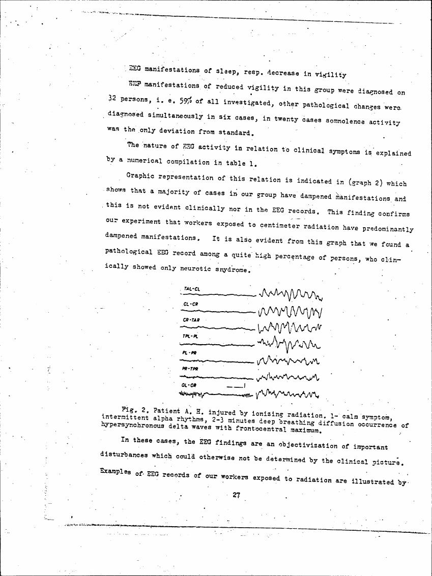 AI-described figure: Figure 2 illustrates EEG recordings from a patient exposed to ionizing radiation, showing intermittent alpha rhythms and delta waves with frontocentral maximum during deep breathing.