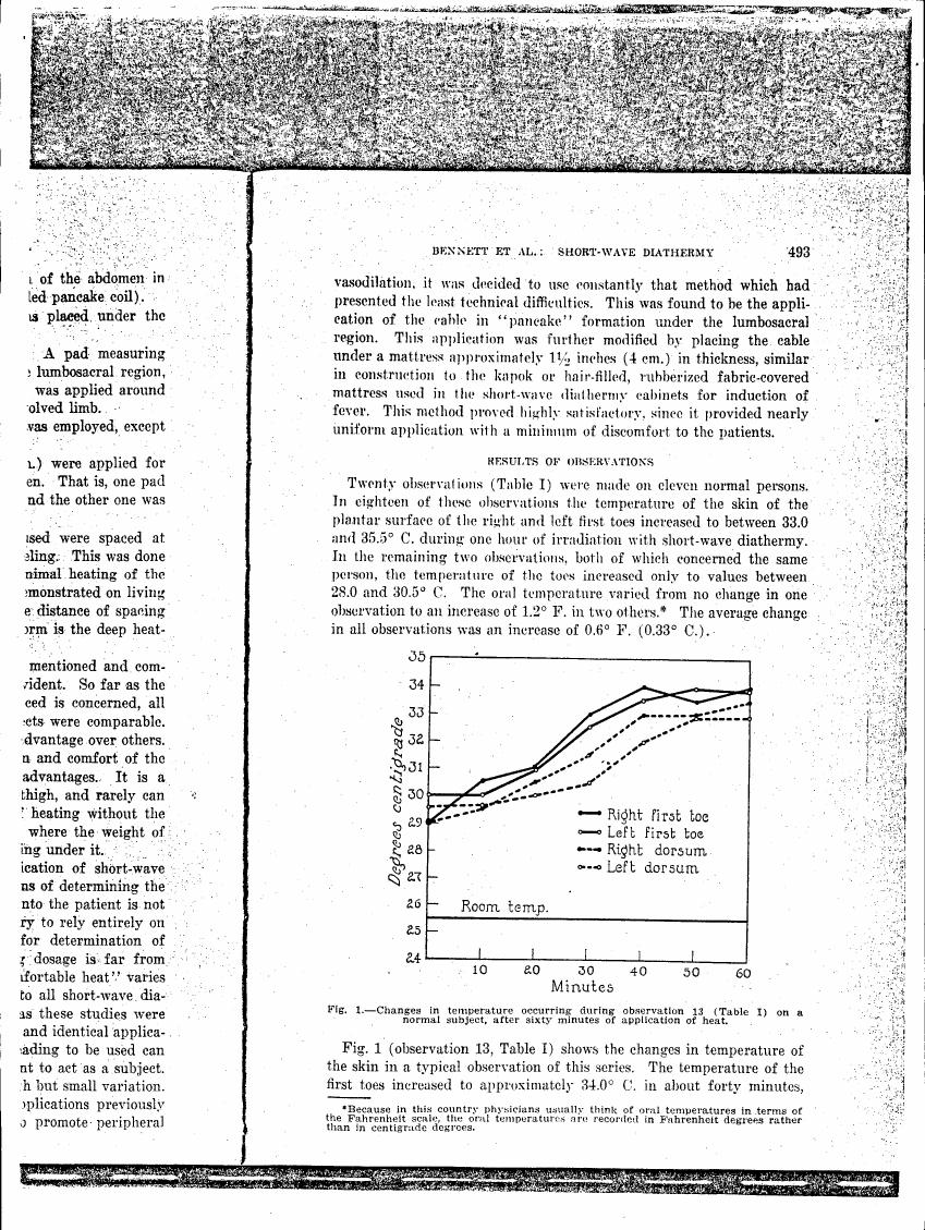 AI-described figure: Fig. 1 (observation 13, Table I) shows changes in temperature occurring during observation on a normal subject after sixty minutes of application of heat.