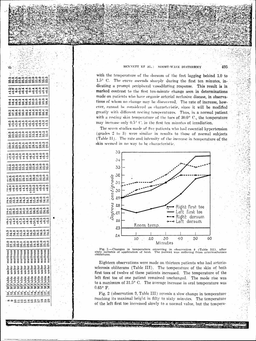 AI-described figure: Fig. 2 displays changes in temperature over time for different body parts during a heat application experiment.