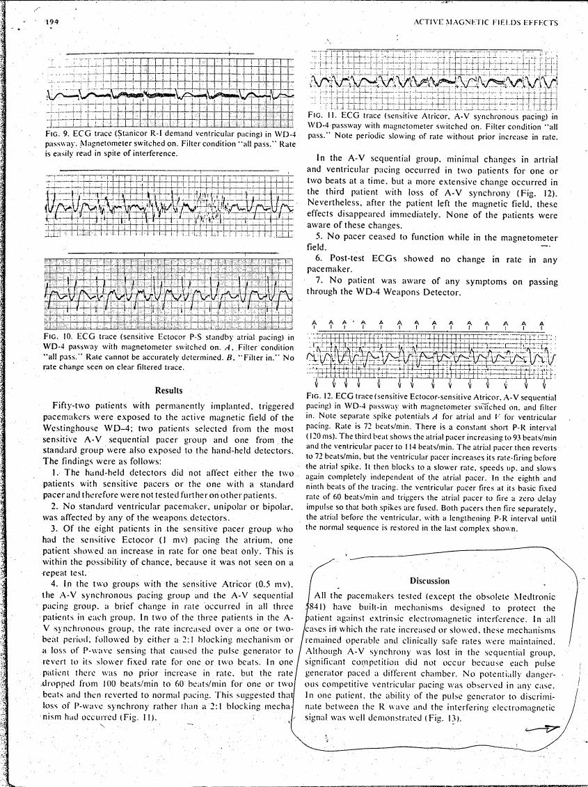 AI-described figure: ECG traces showing effects on pacing rates with and without a magnetometer in WD-4 passway (Figs. 9, 10, 11, 12)