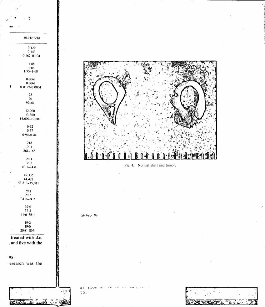 Fig. 4: Normal shaft and tumor.