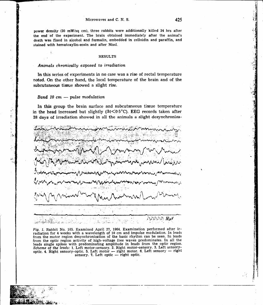 AI-described figure: Figure 1 illustrates EEG recordings from a rabbit after exposure to microwave radiation. It shows desynchronization in motor and sensory regions.