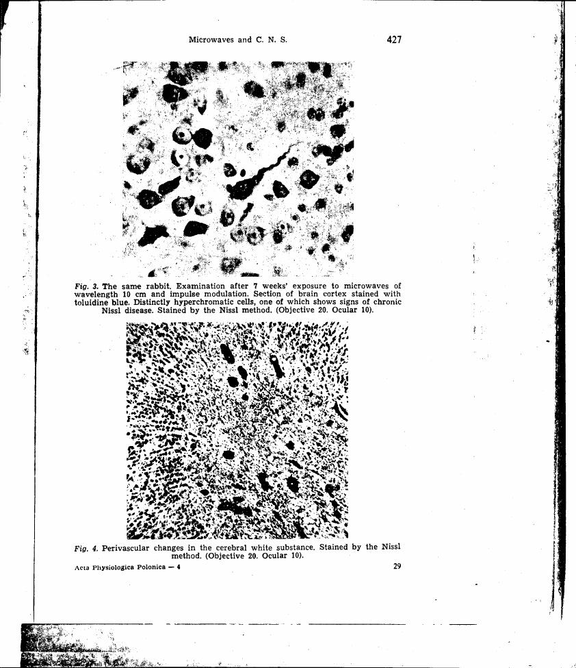Fig. 3: Section of brain cortex stained with toluidine blue showing hyperchromatic cells and signs of chronic Nissl disease after microwave exposure.