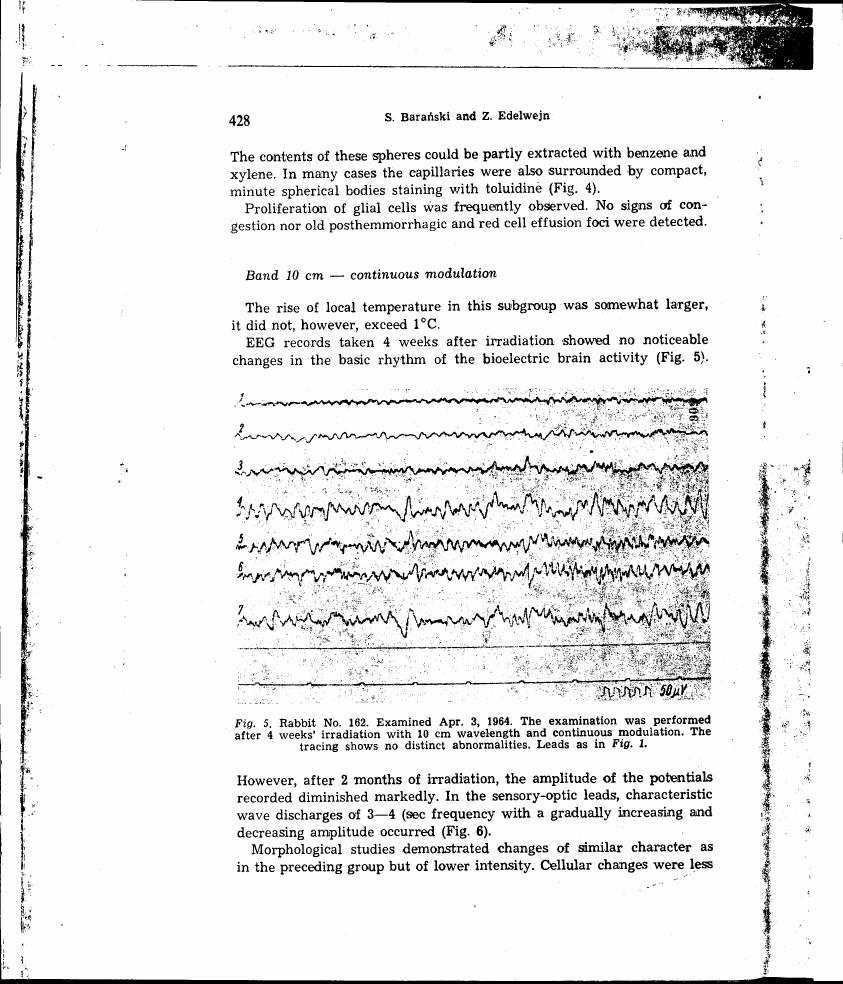 AI-described figure: Electroencephalogram (EEG) records taken after irradiation showing no noticeable changes in brain activity.