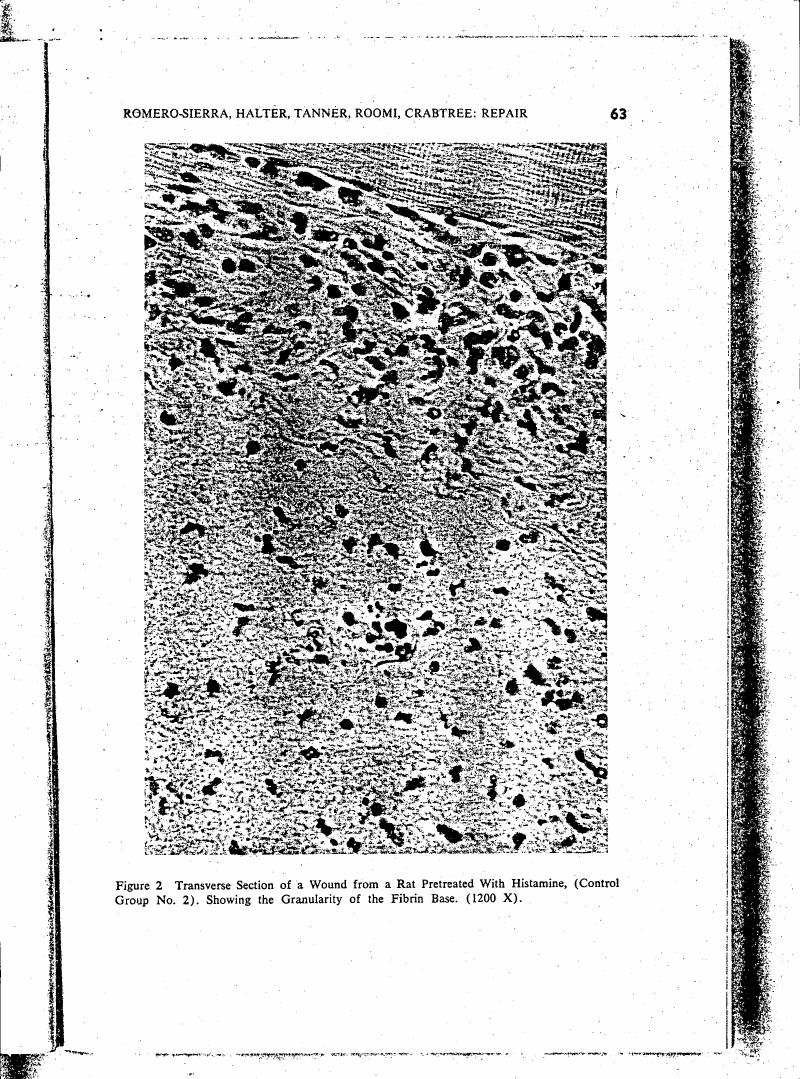 Figure 2: Transverse Section of a Wound from a Rat Pretreated With Histamine (Control Group No. 2), showing the Granularity of the Fibrin Base (1200 X).
