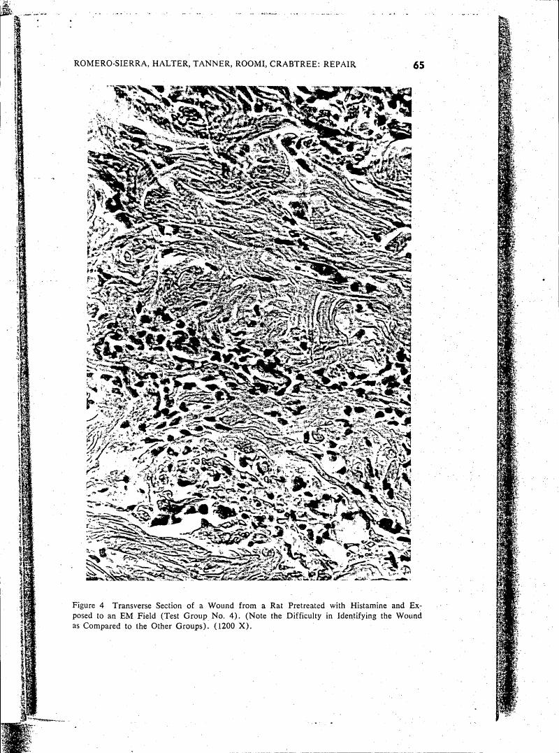 Figure 4: Transverse Section of a Wound from a Rat Pretreated with Histamine and Exposed to an EM Field (Test Group No. 4).