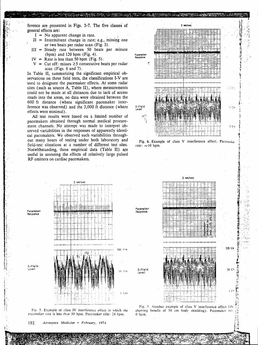 AI-described figure: Examples of class V interference effects on pacemaker responses and E-field levels (Figs. 6-7).