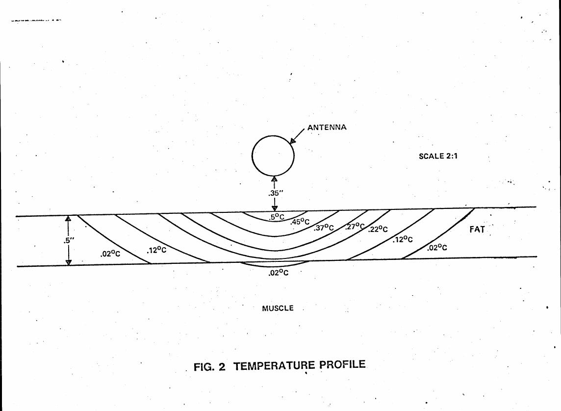 AI-described figure: Figure 2 illustrates a temperature profile showing heat distribution in muscle and fat layers under an antenna.
